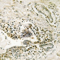 SSH3 Rabbit Polyclonal Antibody