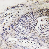 NEFH Rabbit Polyclonal Antibody