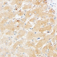 CD109 Rabbit Polyclonal Antibody