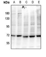 BLNK (Phospho-Y84) Rabbit Polyclonal Antibody