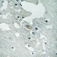 BLNK (Phospho-Y84) Rabbit Polyclonal Antibody