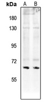 Paxillin (Phospho-S272) Rabbit Polyclonal Antibody