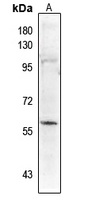 PALF (Phospho-S116) Antibody