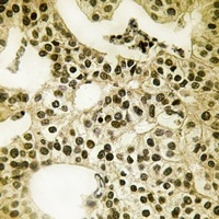 PALF (Phospho-S116) Antibody