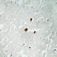 RRN3 (Phospho-S649) Rabbit Polyclonal Antibody