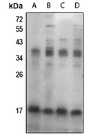 FHIT (Phospho-Y114) Rabbit Polyclonal Antibody