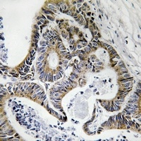 FHIT (Phospho-Y114) Rabbit Polyclonal Antibody
