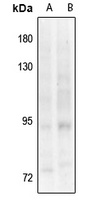 TRK B (Phospho-Y817) Antibody