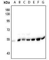 Alpha-tubulin (Phospho-Y272) Antibody