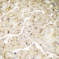VAV3 (Phospho-Y173) Rabbit Polyclonal Antibody