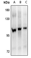 FGFR4 (Phospho-Y642) Antibody