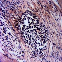 FGFR4 (Phospho-Y642) Antibody