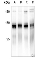 p130 Cas Rabbit Polyclonal Antibody