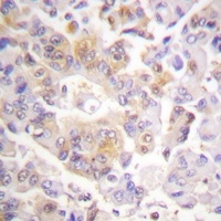 VAV1 Rabbit Polyclonal Antibody