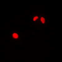TRAP220 Antibody