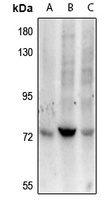 ZAP70 Antibody