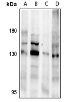 NMDAR1 Rabbit Polyclonal Antibody