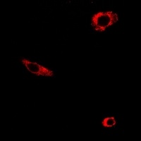 NMDAR1 Rabbit Polyclonal Antibody