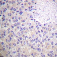 p130 Cas Rabbit Polyclonal Antibody
