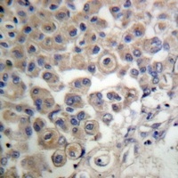 PLC beta 3 Rabbit Polyclonal Antibody
