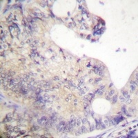 PFKFB2 Rabbit Polyclonal Antibody