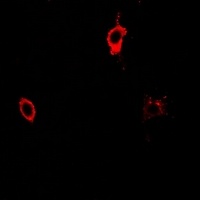 CD25 Antibody