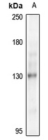 NEK9 Rabbit Polyclonal Antibody