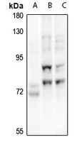 p73 Rabbit Polyclonal Antibody
