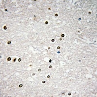 p73 Rabbit Polyclonal Antibody