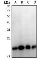 TPD52L2 Rabbit Polyclonal Antibody