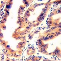TPD52L2 Rabbit Polyclonal Antibody