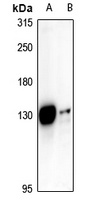 ST18 Rabbit Polyclonal Antibody