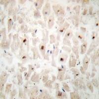 ST18 Rabbit Polyclonal Antibody
