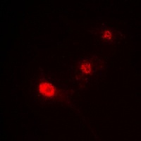 ST18 Rabbit Polyclonal Antibody