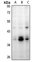 MBD3 Rabbit Polyclonal Antibody