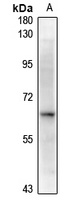 Alpha-2B Adrenergic Receptor Rabbit Polyclonal Antibody