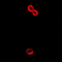 Alpha-2B Adrenergic Receptor Rabbit Polyclonal Antibody