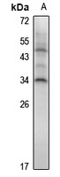 HOXA7 Rabbit Polyclonal Antibody