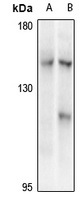 CIITA Rabbit Polyclonal Antibody