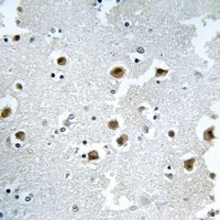 CAF-I p60 Rabbit Polyclonal Antibody