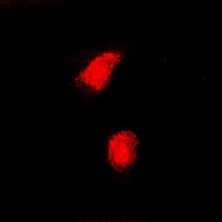 CAF-I p60 Rabbit Polyclonal Antibody