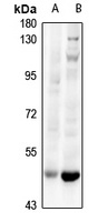HLX Rabbit Polyclonal Antibody