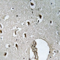 HLX Rabbit Polyclonal Antibody