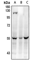 WTAP Rabbit Polyclonal Antibody