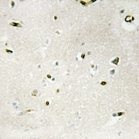 WTAP Rabbit Polyclonal Antibody