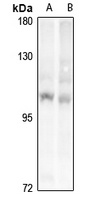 PRKD1/2/3 Rabbit Polyclonal Antibody