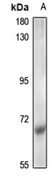 CDK5RAP1 Rabbit Polyclonal Antibody
