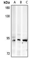 AMPD3 Rabbit Polyclonal Antibody