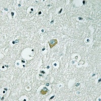 AMPD3 Rabbit Polyclonal Antibody