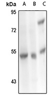 Carboxypeptidase M Rabbit Polyclonal Antibody